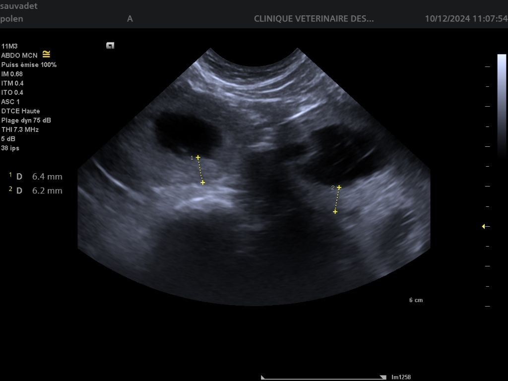 1ère échographie 